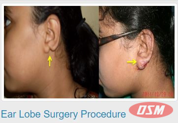 Best Cosmetic And Plastic Surgeon In Vizag