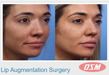 Best Cosmetic And Plastic Surgeon In Vizag