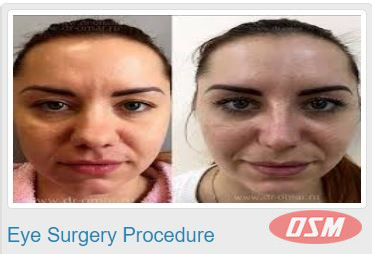 Best Cosmetic Surgeon In Hyderabad - Dr YV Rao Clinics